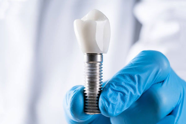 Swiss Machining Dental Implants